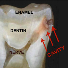 3 parts of a tooth explained in diagram.